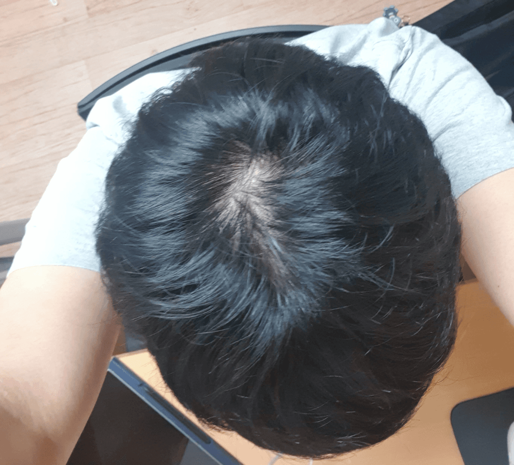 1번 째 사진
