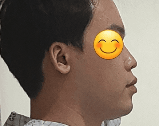 2번 째 사진