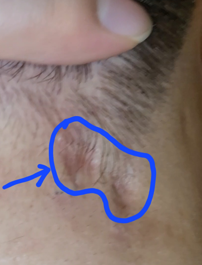 2번 째 사진