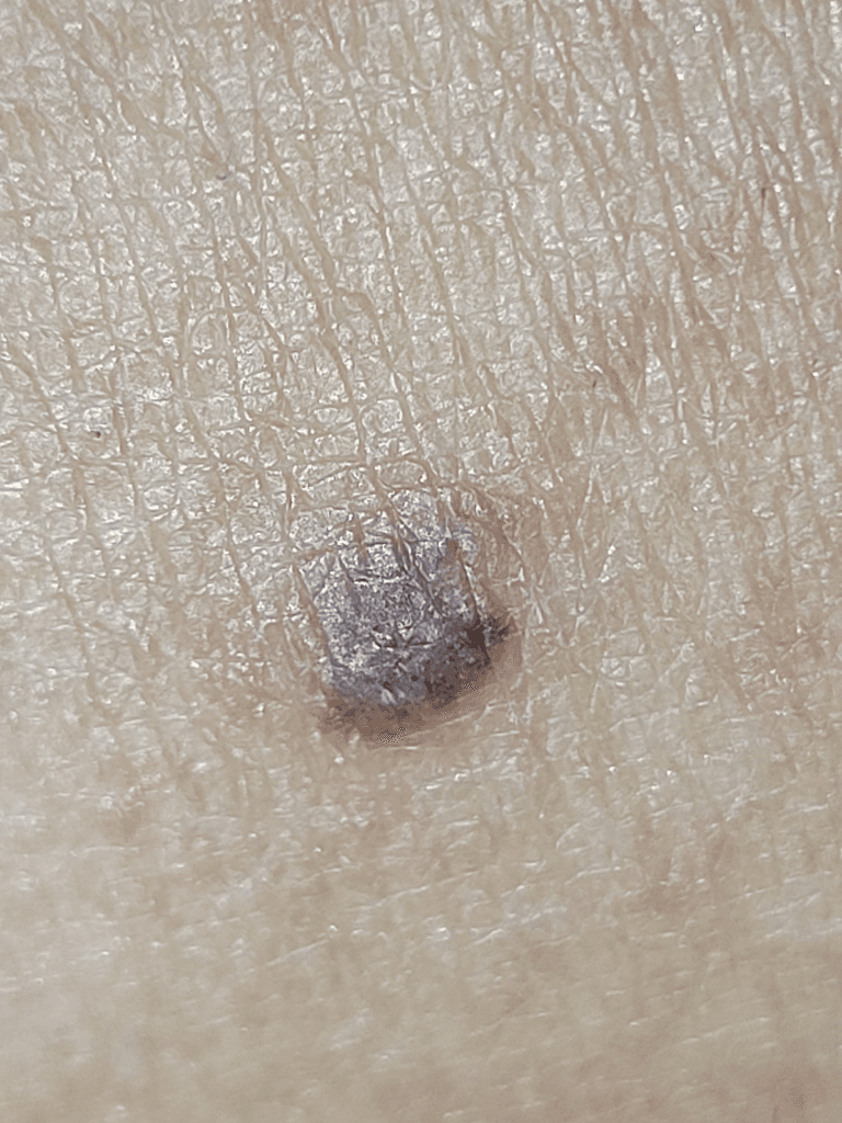 2번 째 사진