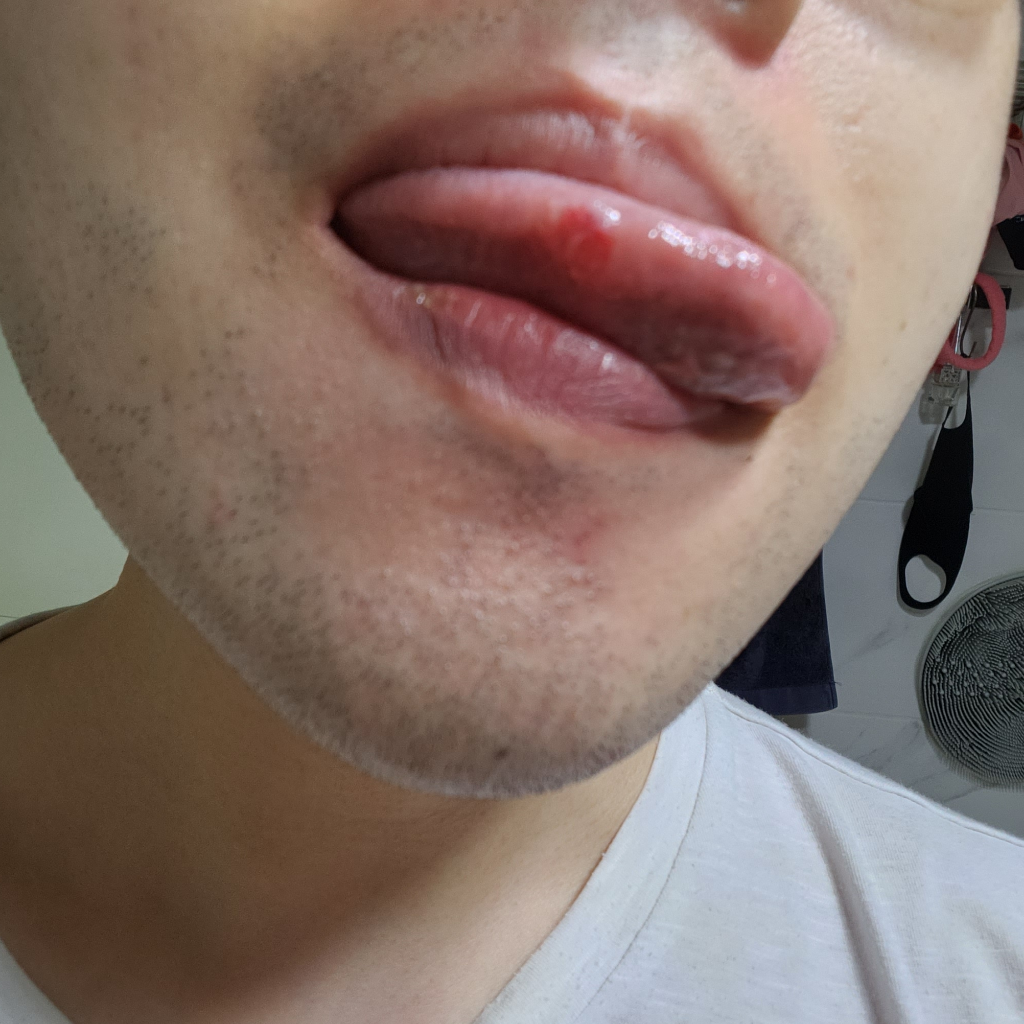 1번 째 사진
