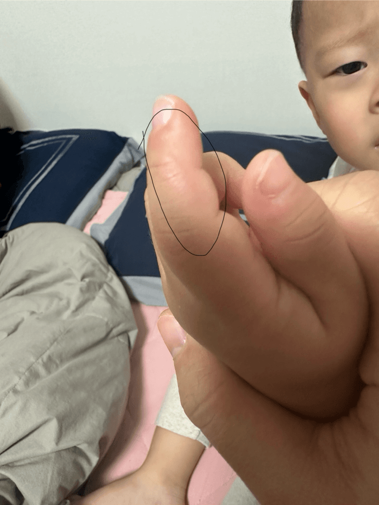 1번 째 사진