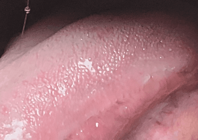 2번 째 사진