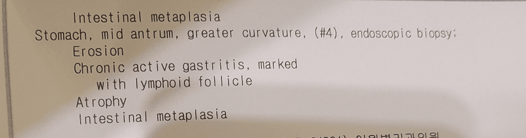 2번 째 사진