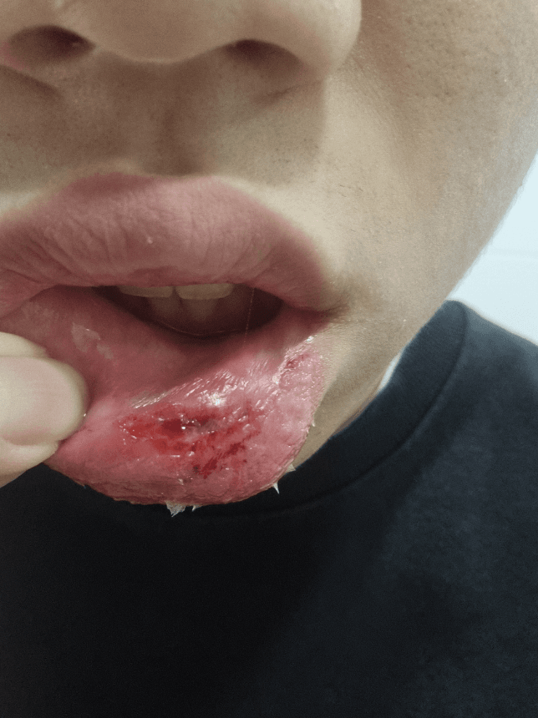 1번 째 사진