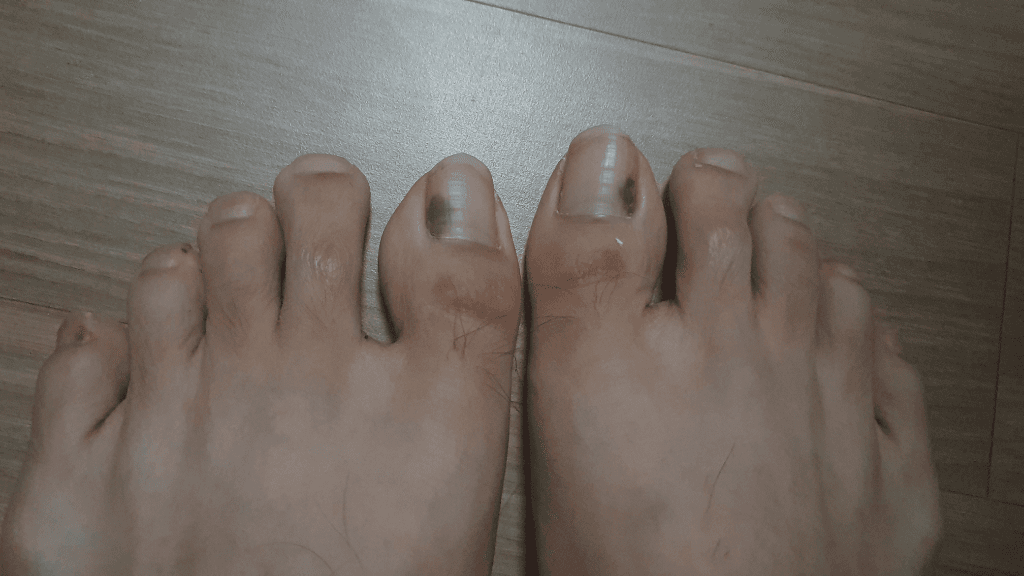 1번 째 사진