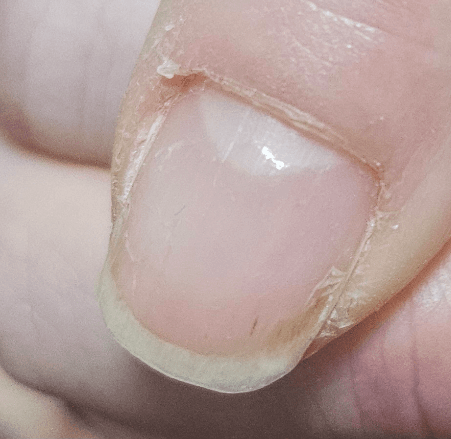 3번 째 사진