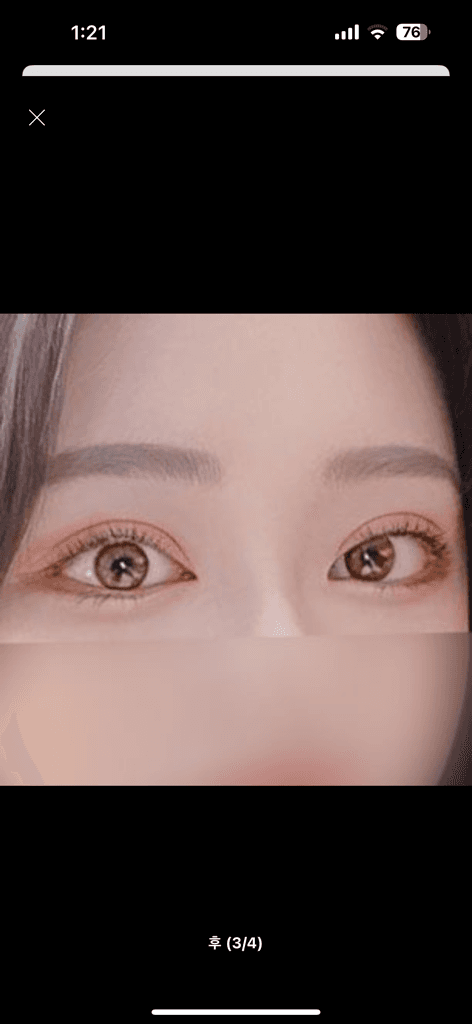 2번 째 사진