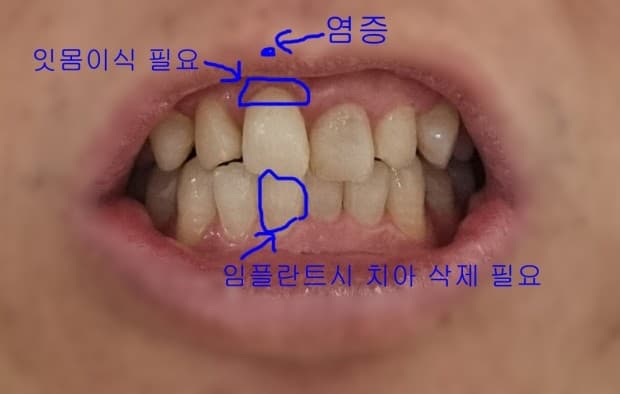 2번 째 사진