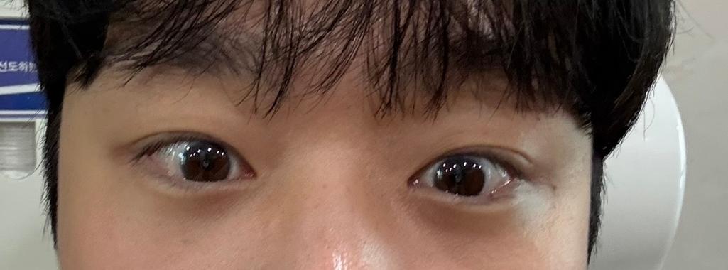 2번 째 사진