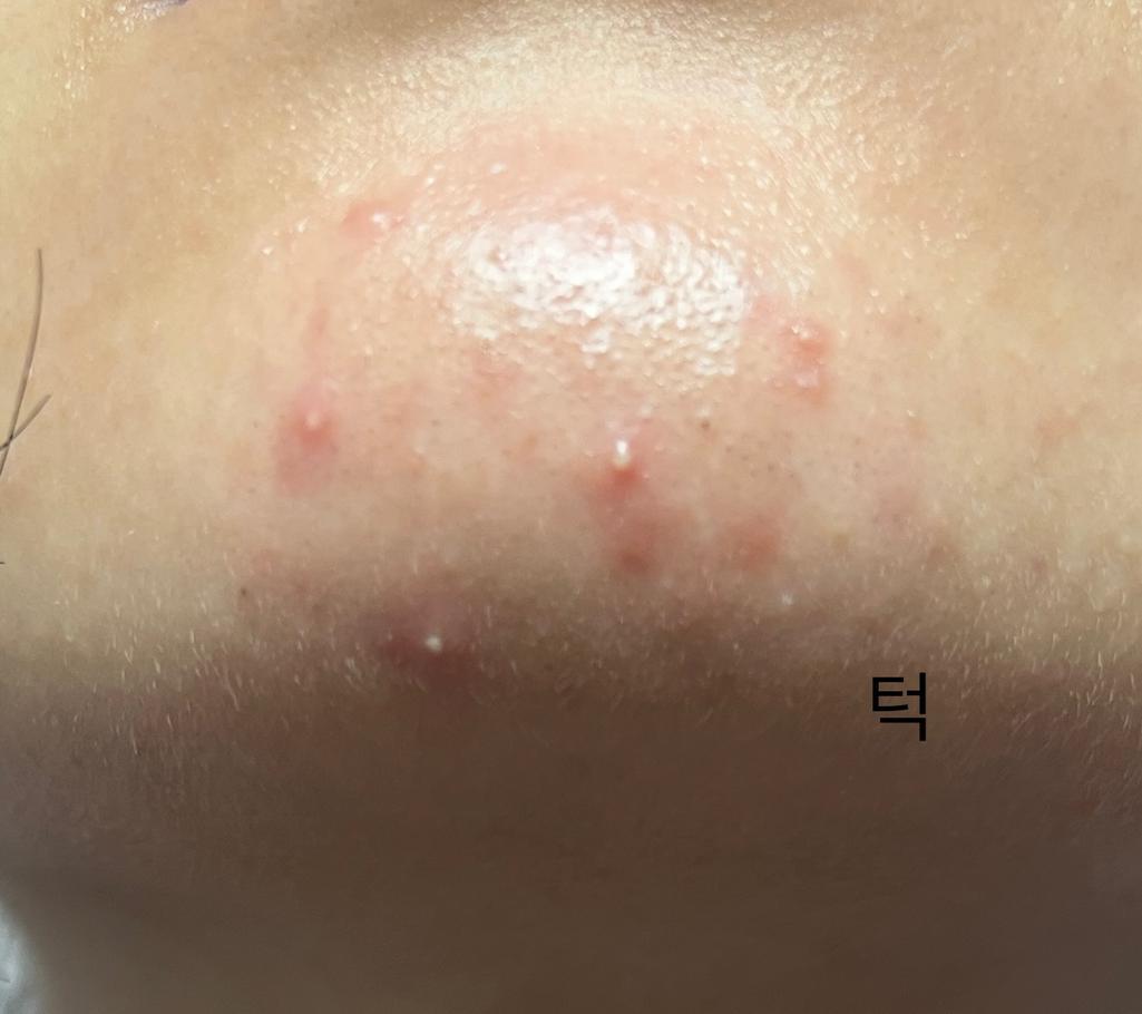 3번 째 사진