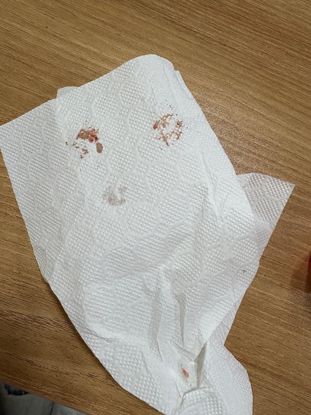 2번 째 사진