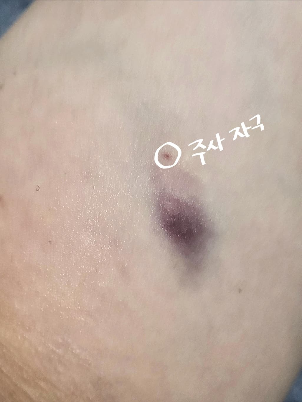 2번 째 사진