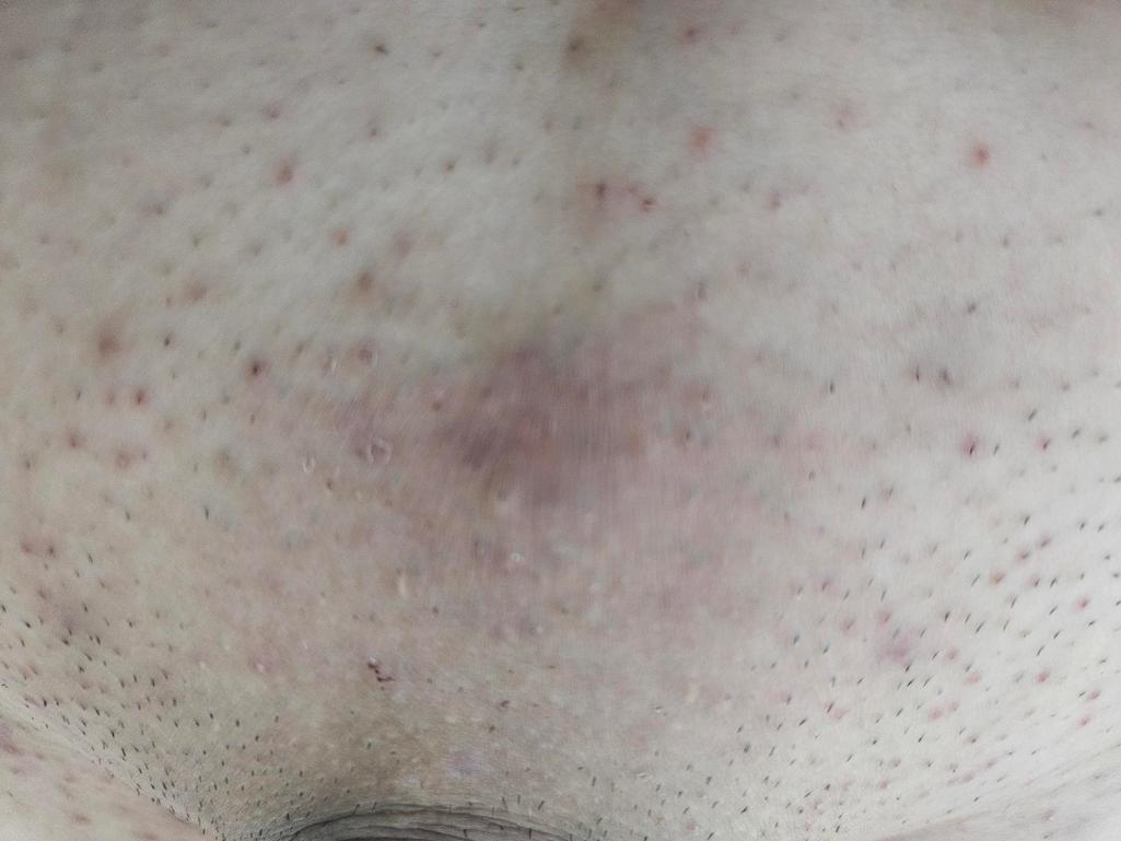 2번 째 사진