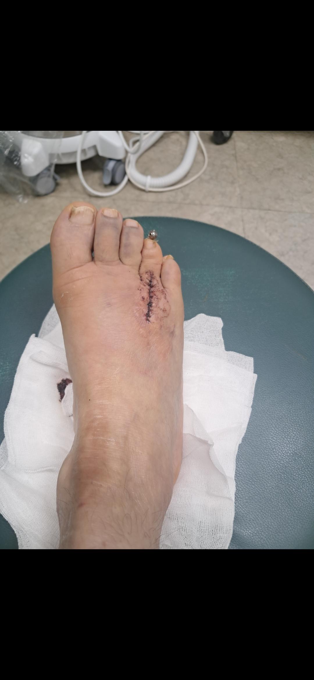 2번 째 사진