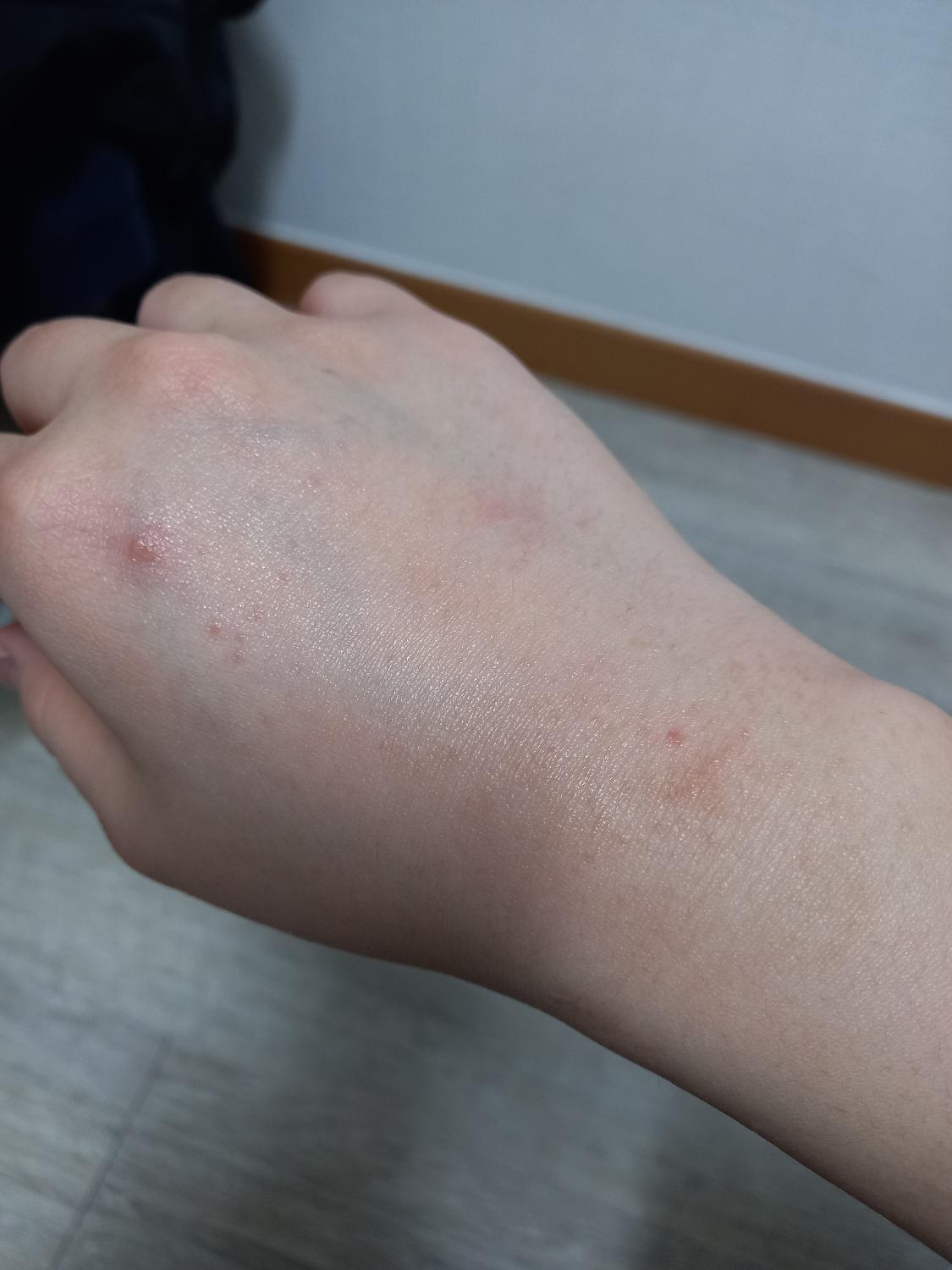2번 째 사진