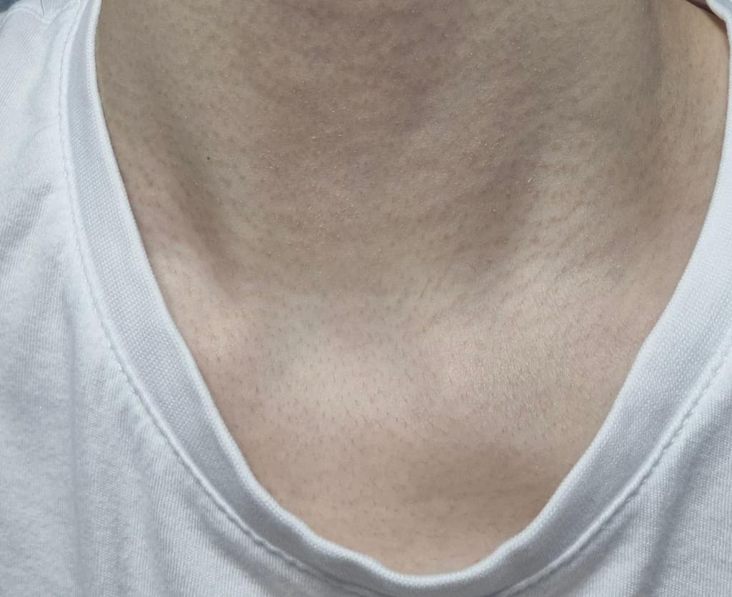 9번 째 사진