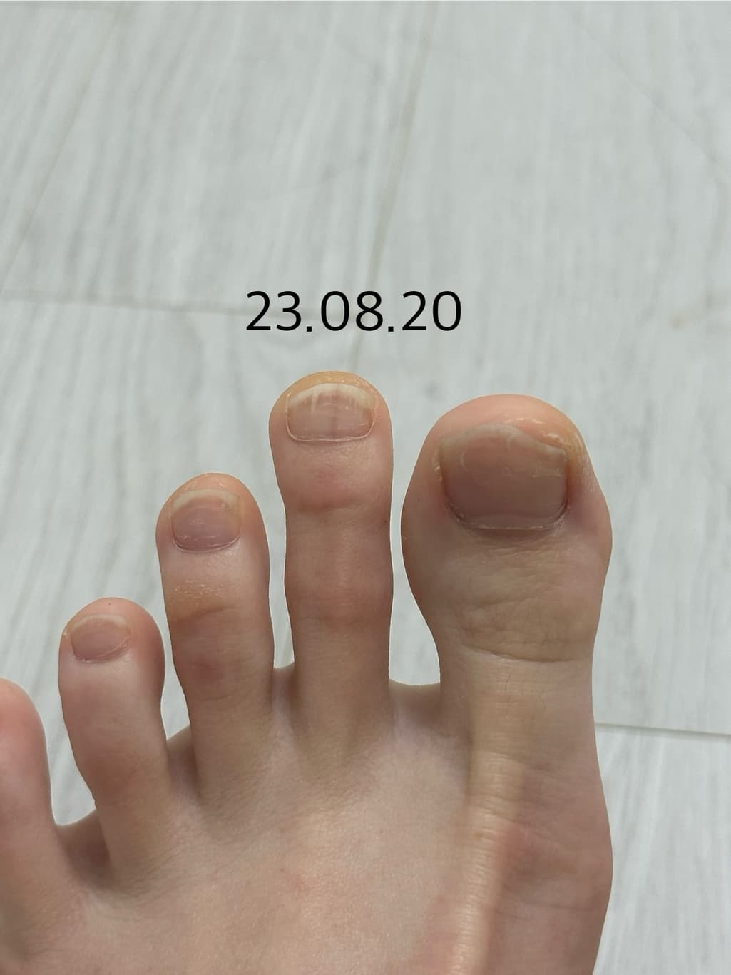 5번 째 사진
