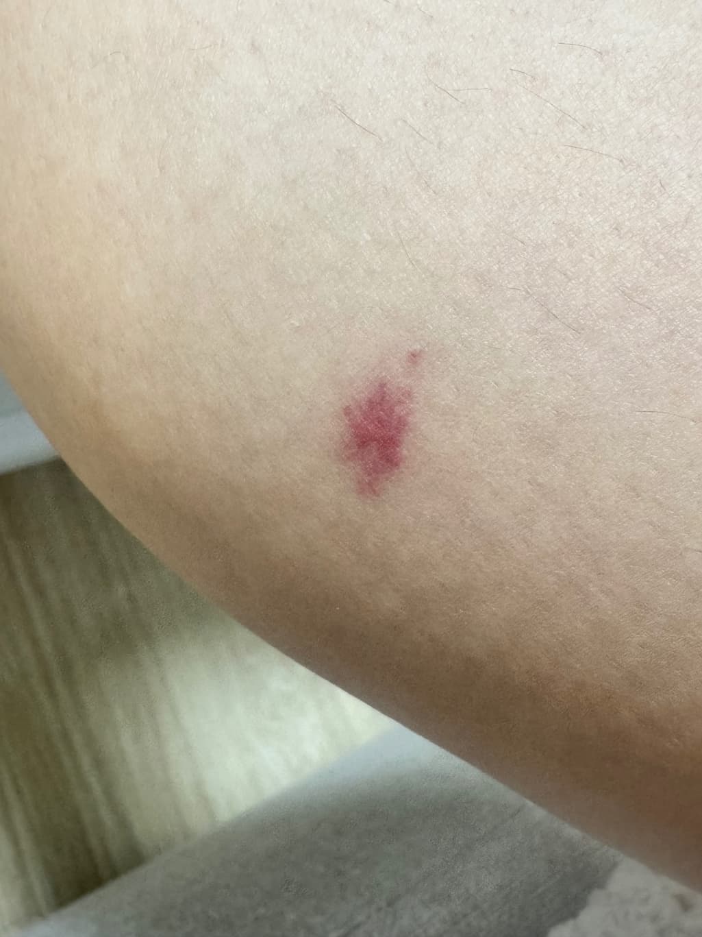 2번 째 사진