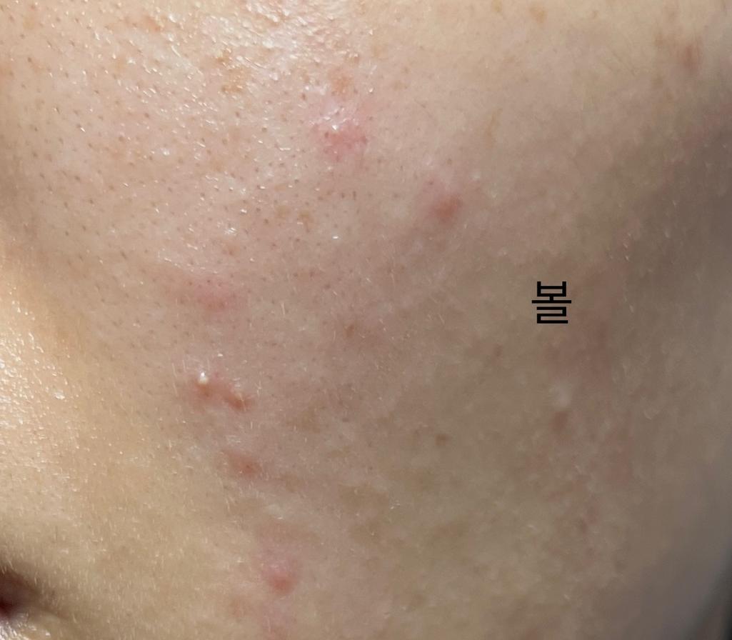 2번 째 사진