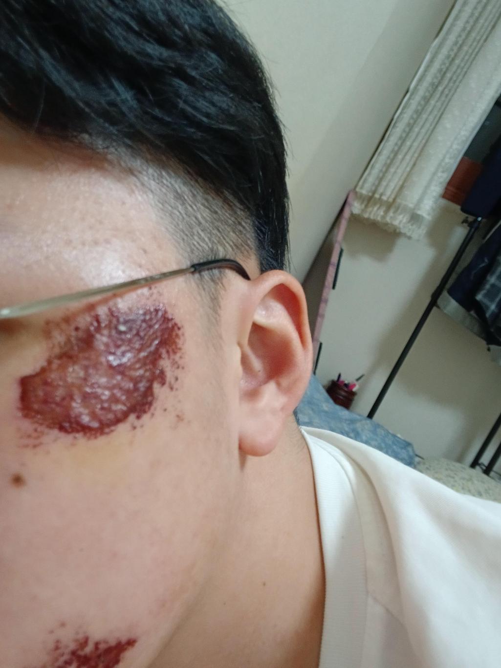 1번 째 사진
