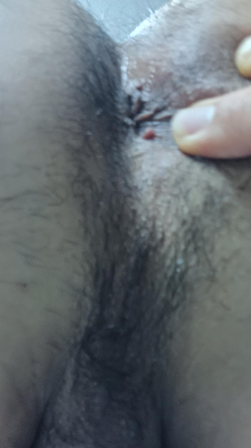 2번 째 사진