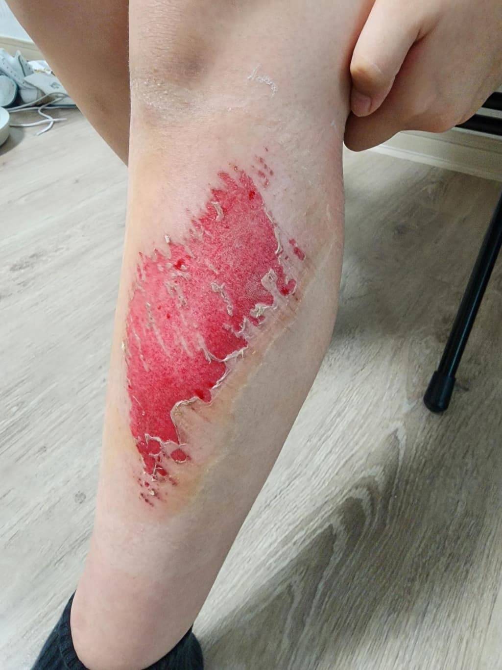 1번 째 사진