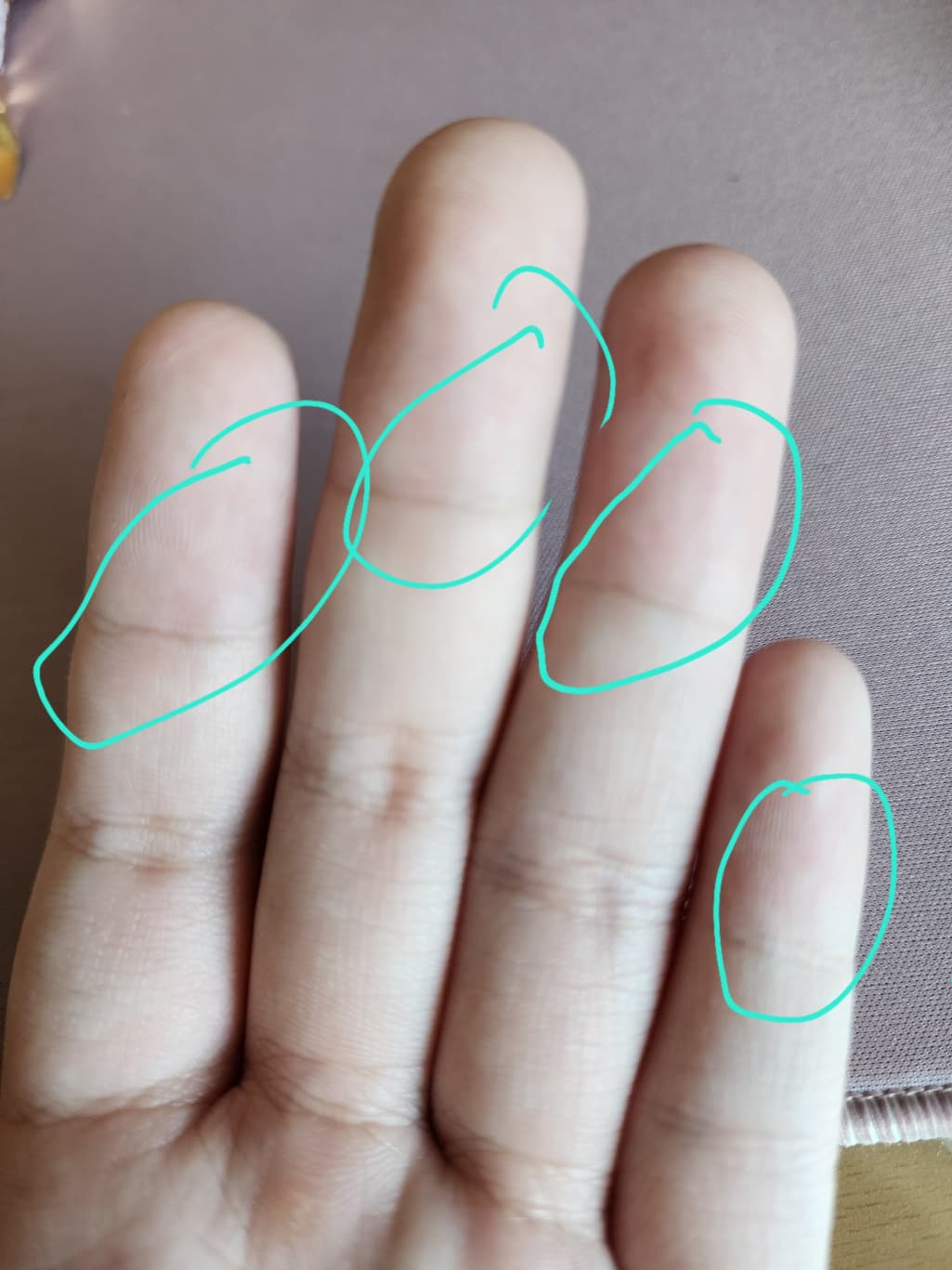 3번 째 사진