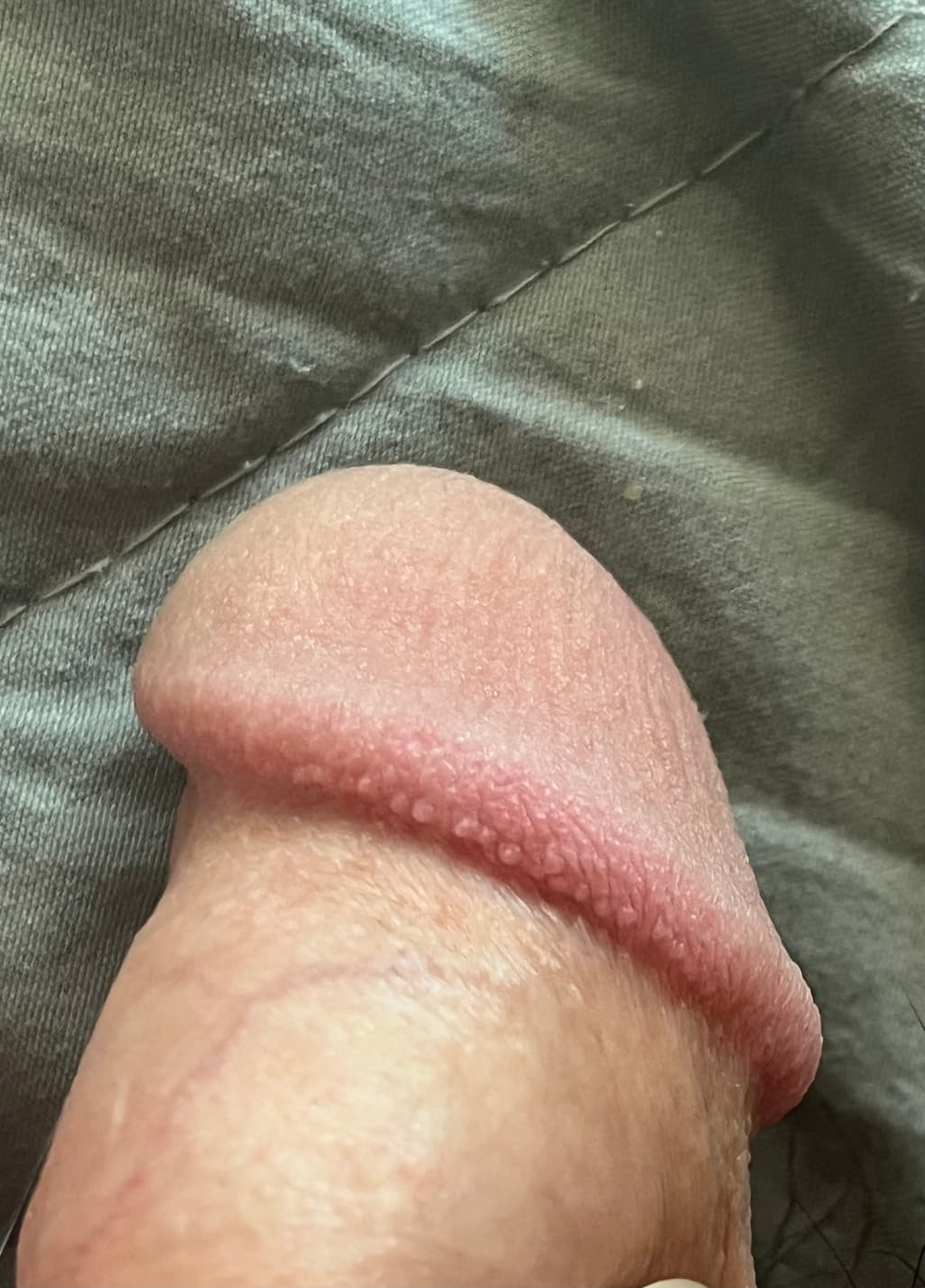 2번 째 사진