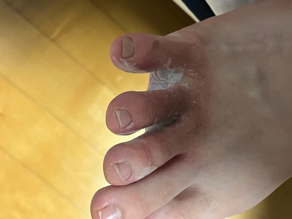 2번 째 사진
