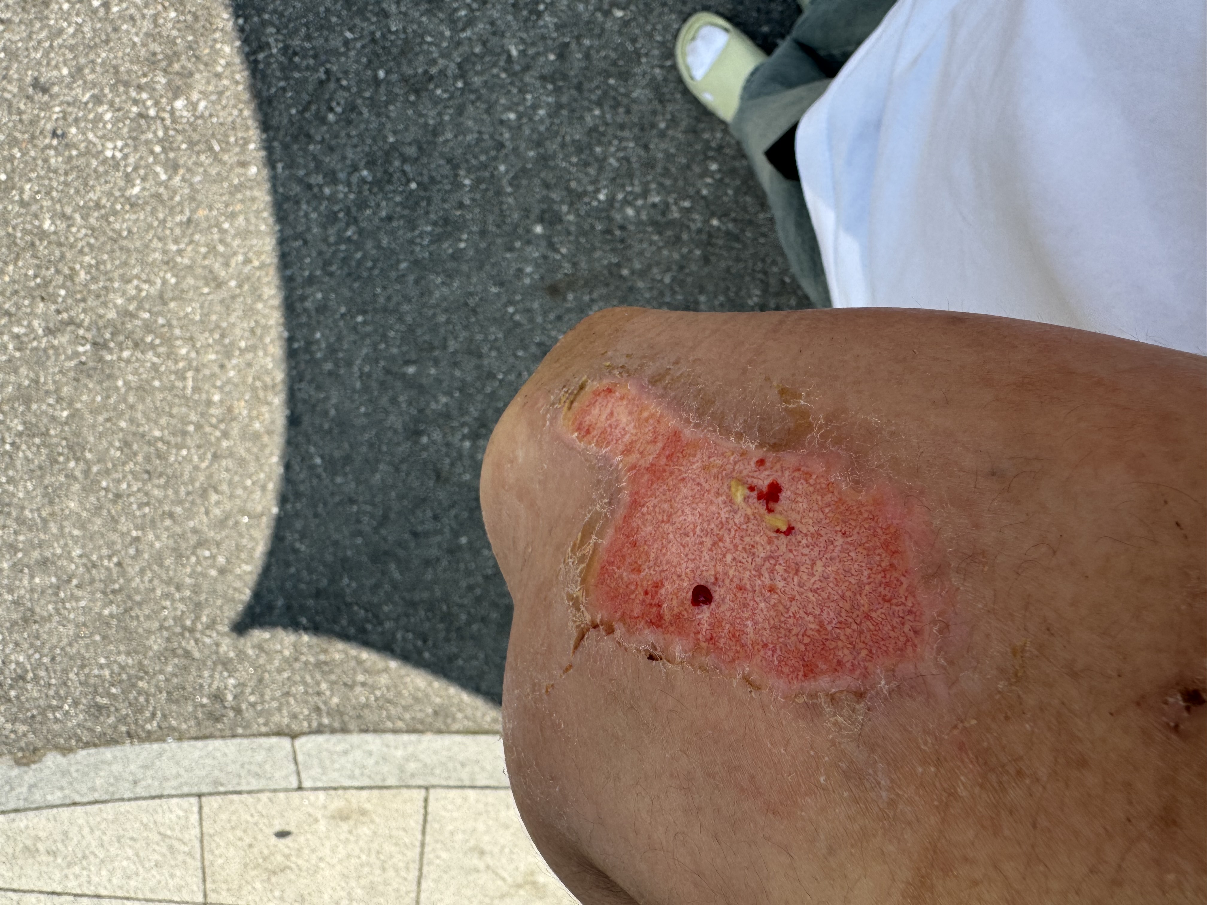 2번 째 사진