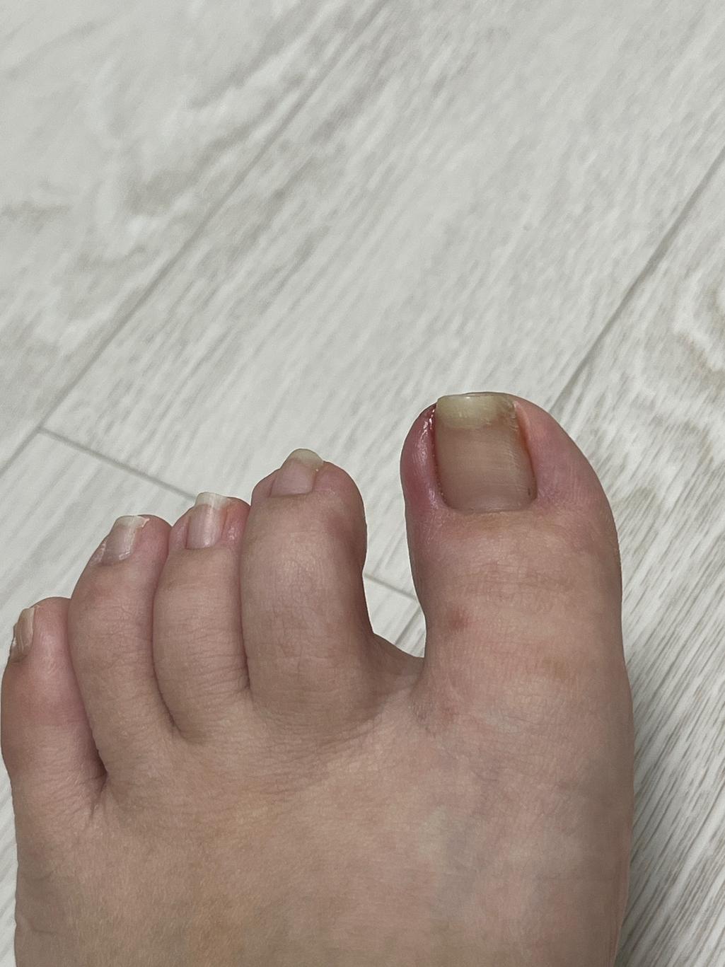 3번 째 사진