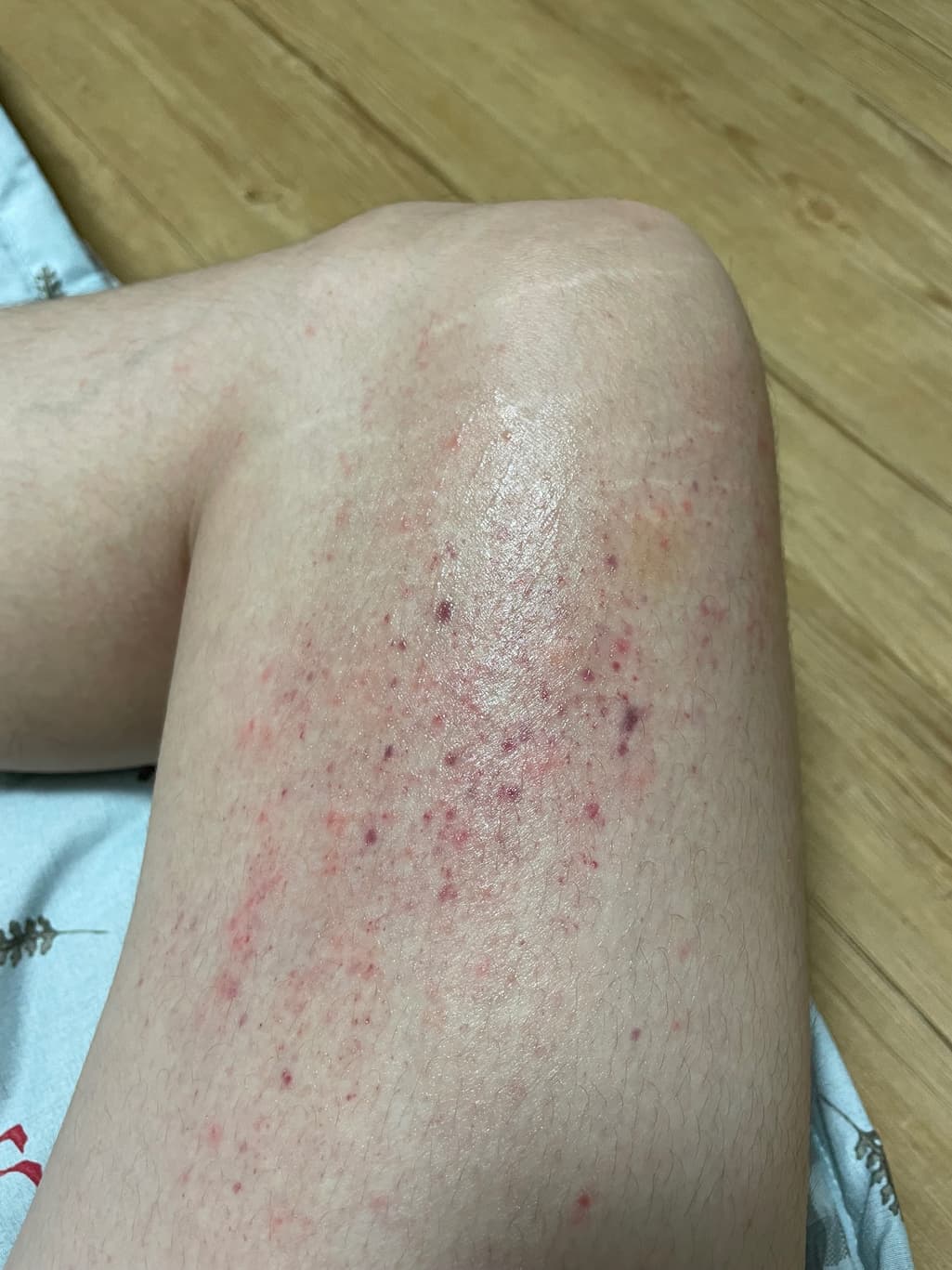 2번 째 사진