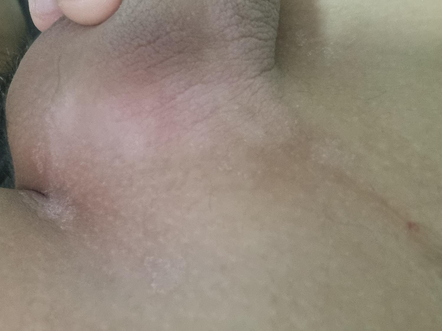 3번 째 사진