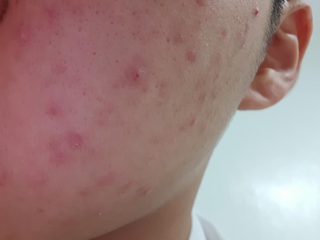 2번 째 사진