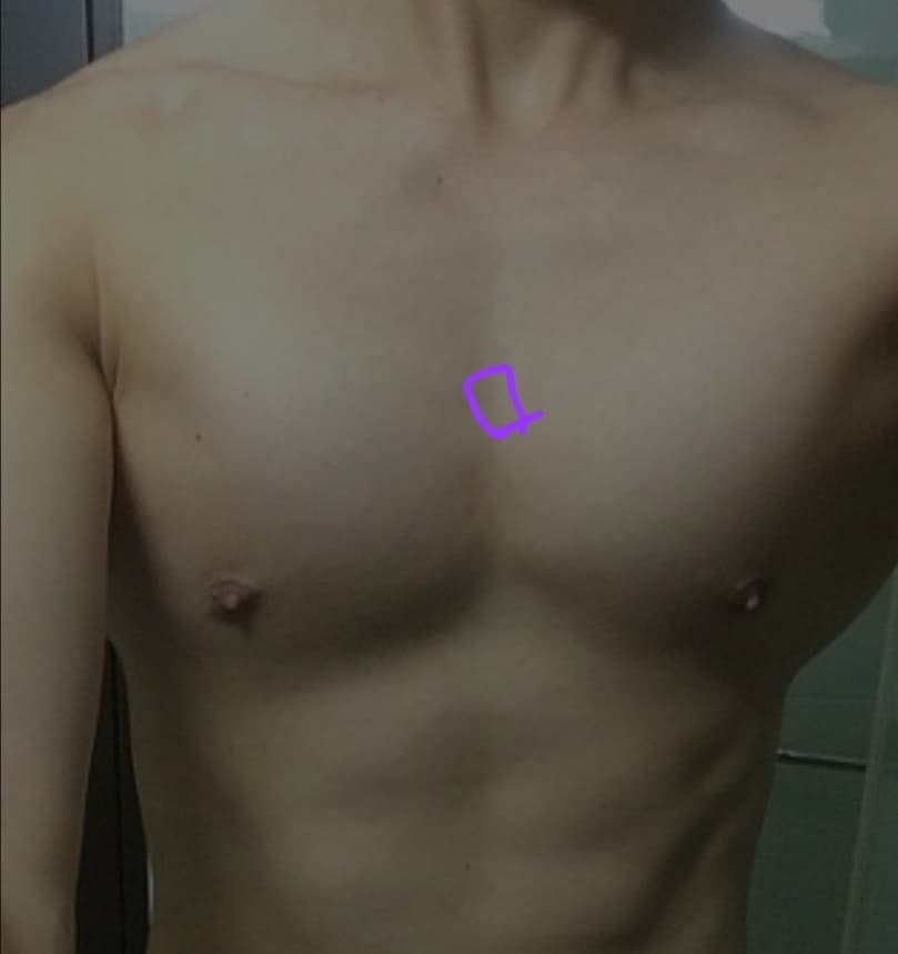 1번 째 사진