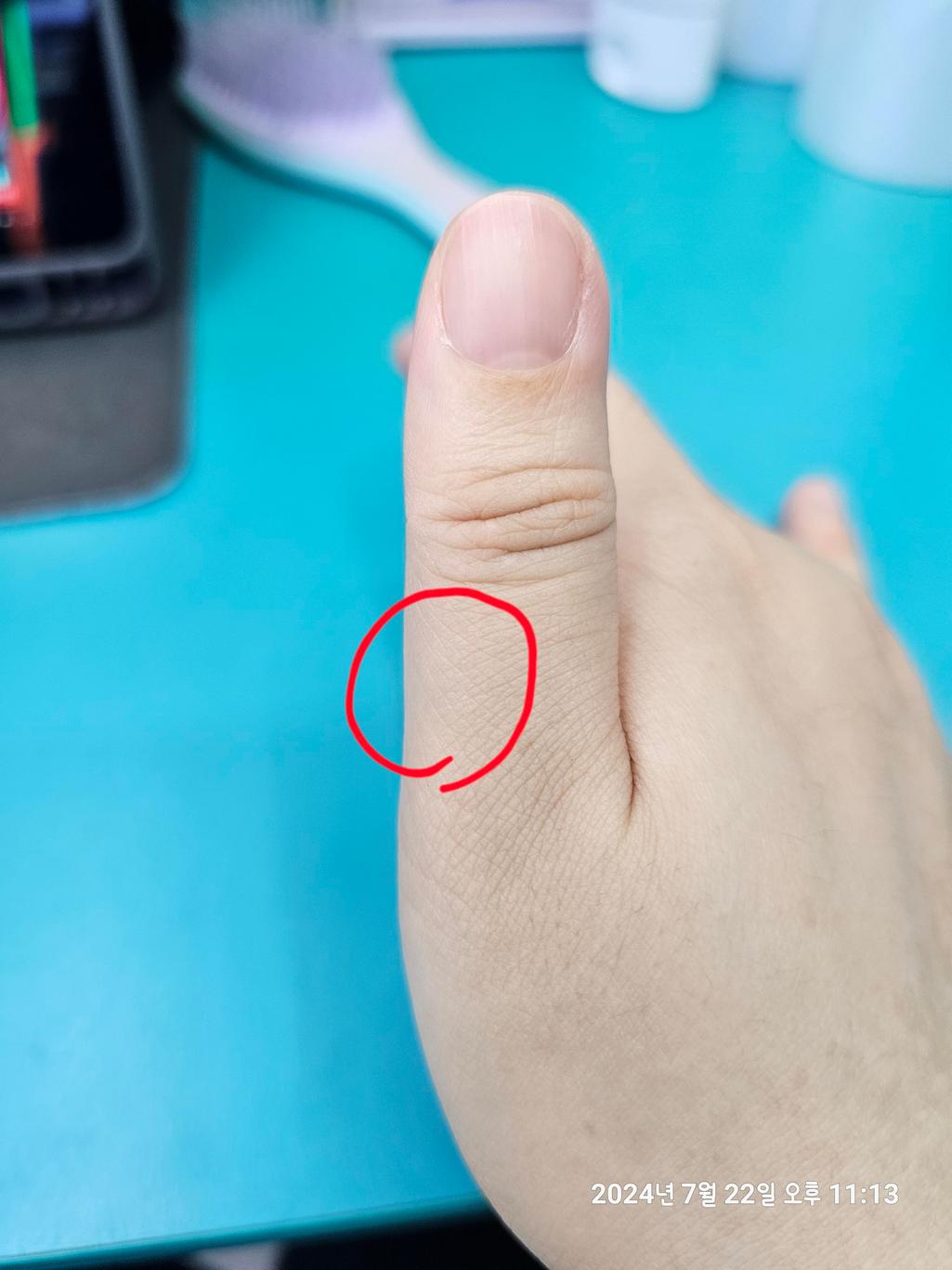 1번 째 사진