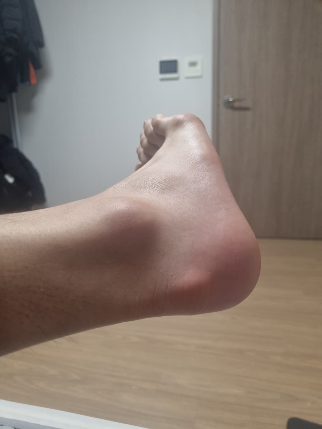 2번 째 사진