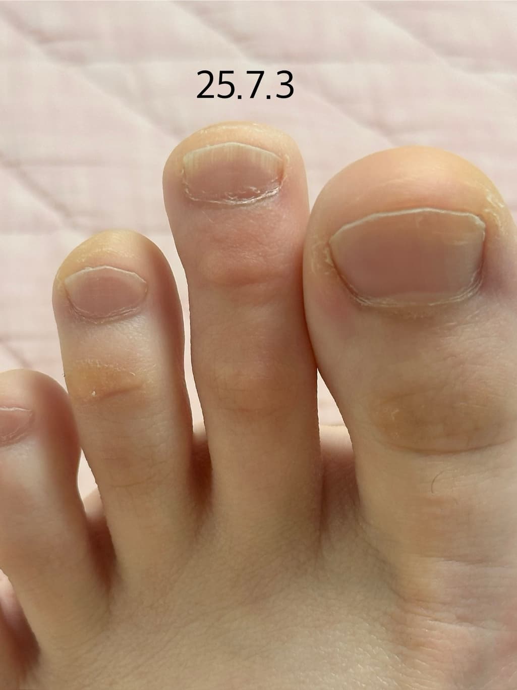 11번 째 사진
