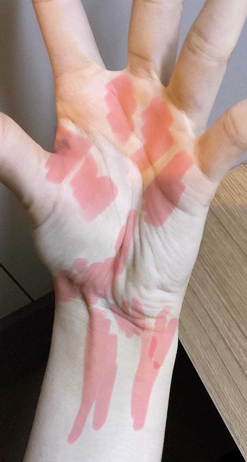 2번 째 사진