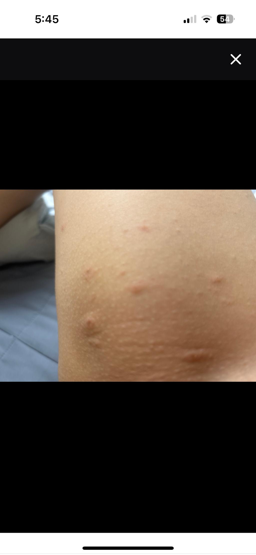 3번 째 사진