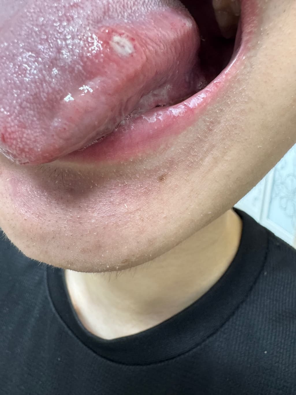 2번 째 사진