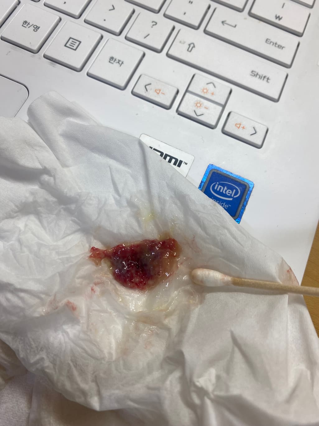 2번 째 사진