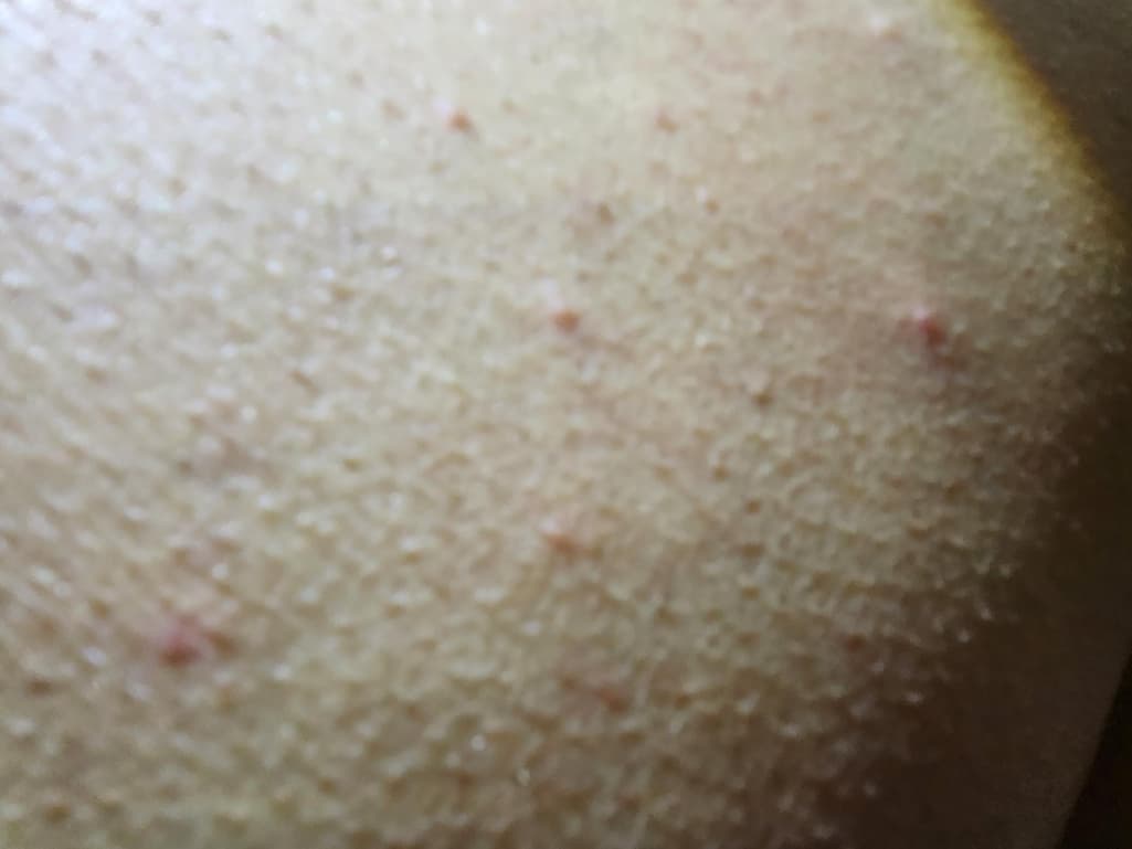 3번 째 사진