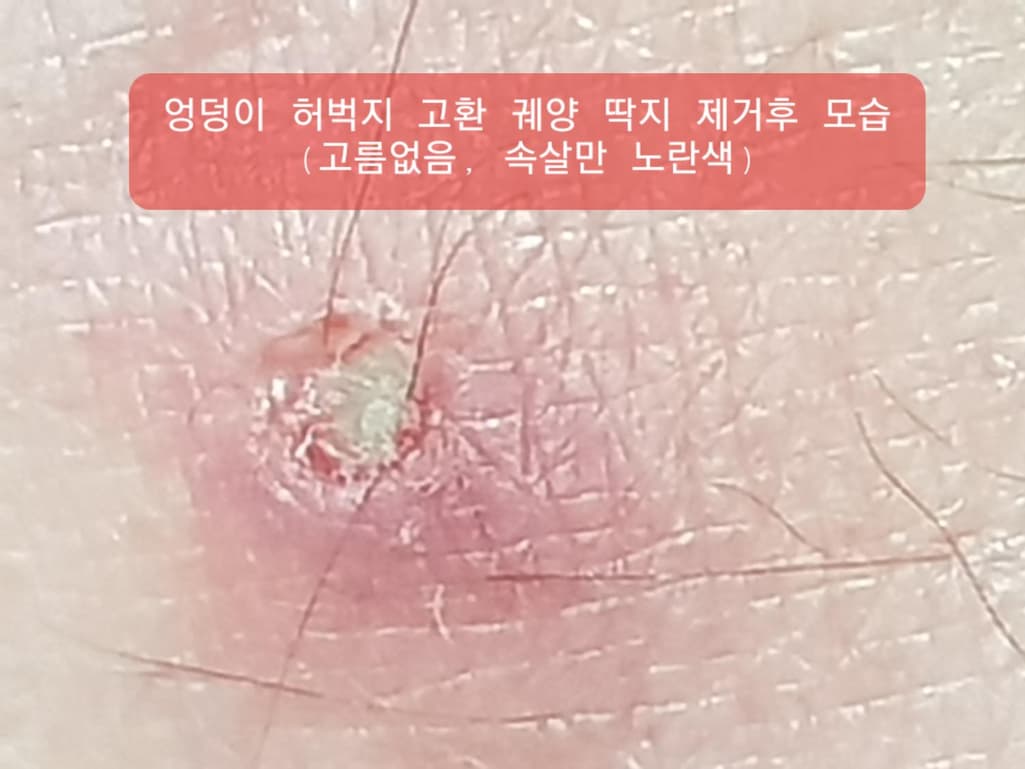 2번 째 사진
