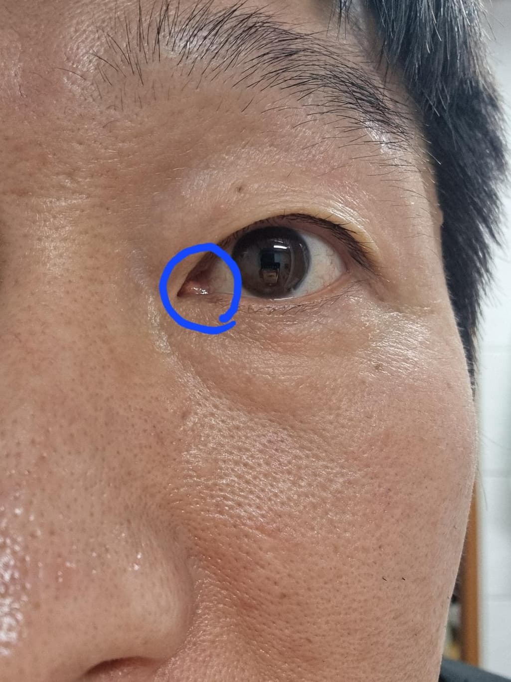 2번 째 사진
