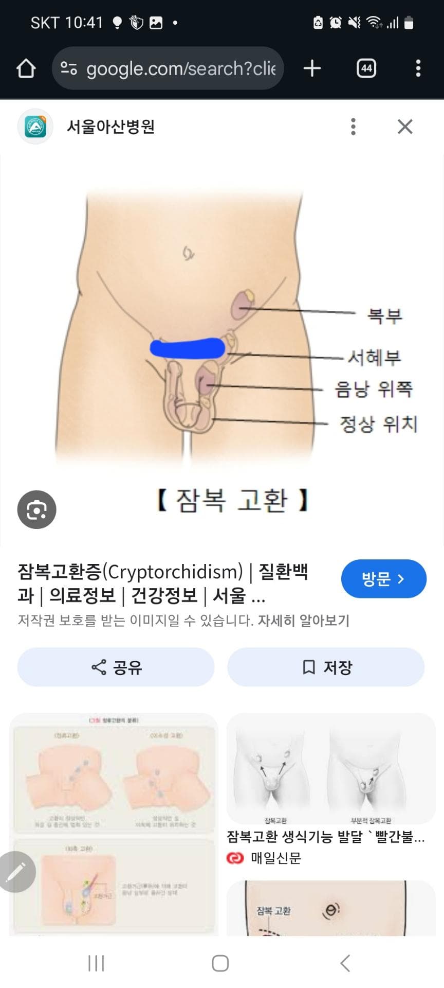 2번 째 사진