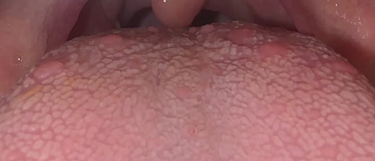 2번 째 사진