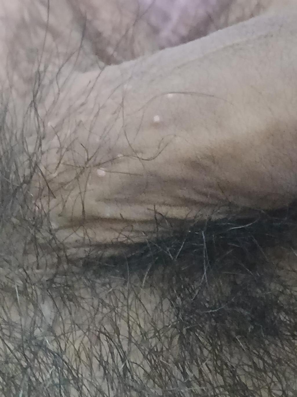 2번 째 사진