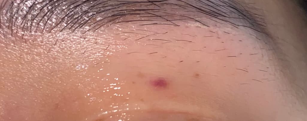 2번 째 사진